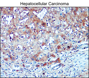 Collagen II Rabbit Polyclonal Antibody
