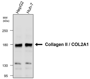 Collagen II Rabbit Polyclonal Antibody