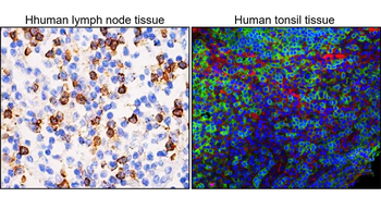 Human CD8 Mouse Monoclonal Antibody