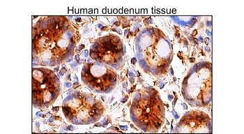 Phospho p38 MAPK (Thr180Tyr182) Mouse Monoclonal Antibody