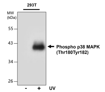 Phospho p38 MAPK (Thr180Tyr182) Mouse Monoclonal Antibody