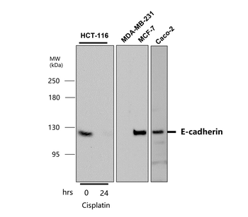 EMT Marker Antibody Panel