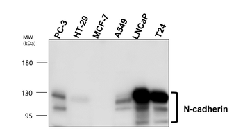 EMT Marker Antibody Panel