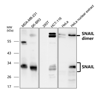 EMT Marker Antibody Panel