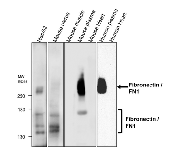 EMT Marker Antibody Panel