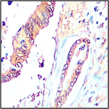 Extracellular Matrix / ECM Profiling Antibody Panel