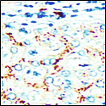Extracellular Matrix / ECM Profiling Antibody Panel