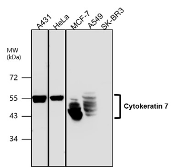 Cytokeratin Antibody Panel