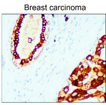 Cytokeratin Antibody Panel