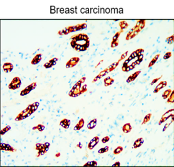 Cytokeratin Antibody Panel