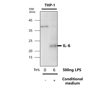 Inflammation Antibody Panel