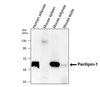 Adipogenesis Marker Antibody Panel