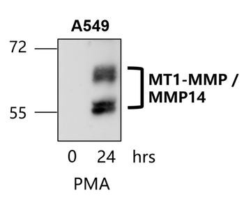 Matrix Remodeling Antibody Panel