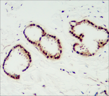 Breast Cancer Biomarkers Antibody Panel