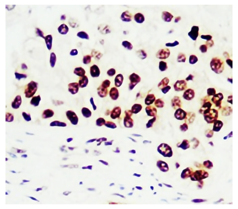 PCNA, monoclonal antibody