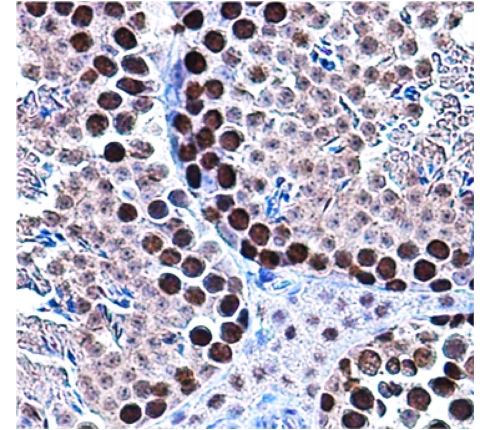PCNA, monoclonal antibody