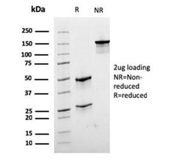 Recombinant Desmin Antibody