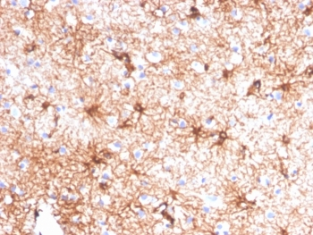Glial Fibrillary Acidic Protein Antibody / GFAP