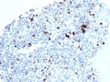 Recombinant TIA-1 Antibody / T-Cell Intracellular Antigen-1
