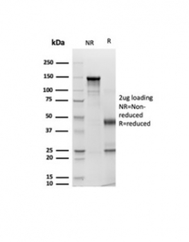 Recombinant Pan-CK Antibody Cocktail