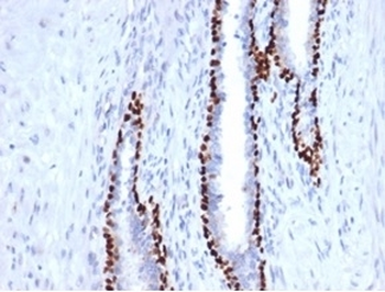 Recombinant deltaNp63 Antibody / p40