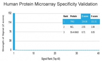 p63 Antibody / Tumor protein 63
