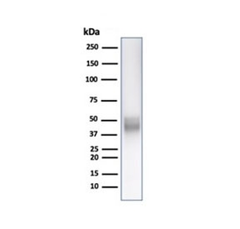 Recombinant CD5 Antibody