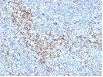 Recombinant CD5 Antibody