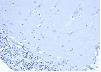 Recombinant CD5 Antibody