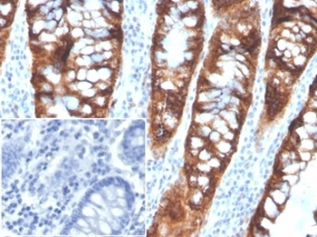PDGFB Antibody