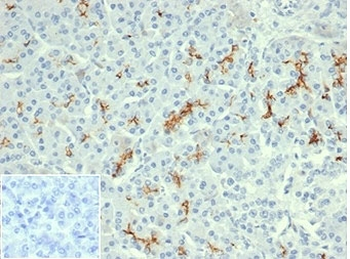 Recombinant Cystic Fibrosis Transmembrane Regulator Antibody / CFTR