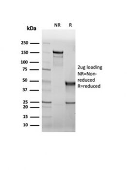 Recombinant Cystic Fibrosis Transmembrane Regulator Antibody / CFTR