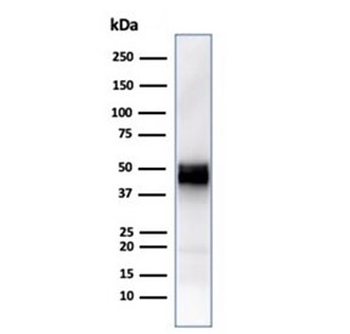 Recombinant CD5 Antibody