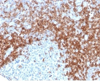 Recombinant CD5 Antibody