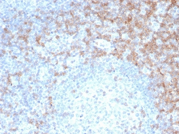 Recombinant CD5 Antibody