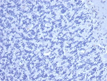 Recombinant Carcinoembryonic Antigen Antibody / CEA