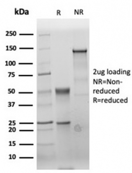 Recombinant Carcinoembryonic Antigen Antibody / CEA