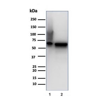 Recombinant HSPD1 Antibody / HSP60