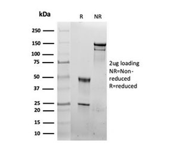 Recombinant HSPD1 Antibody / HSP60