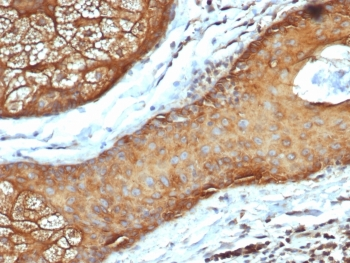 Recombinant Acidic Cytokeratin Antibody (LMW / Type I)