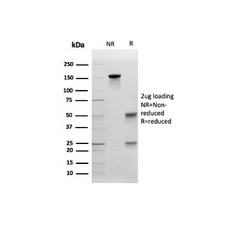 Cadherin 1 Antibody / CDH1 / E-Cadherin