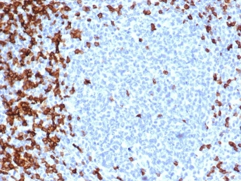 Recombinant CD7 Antibody