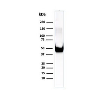 Vimentin Antibody