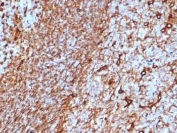 Vimentin Antibody