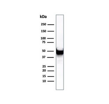 Recombinant VIM Antibody / Vimentin