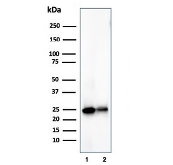 PGP9.5 / UchL1 Antibody