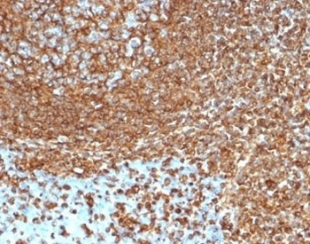 Recombinant Vimentin Antibody