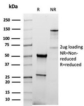 Recombinant TPO Antibody / Thyroid Peroxidase