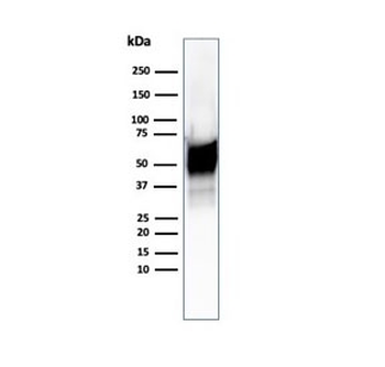 Recombinant HSP60 Antibody