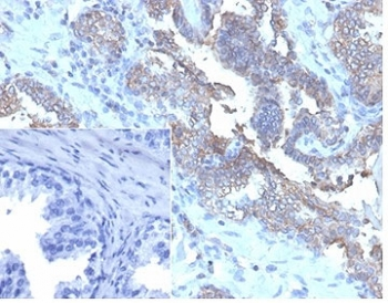 CD47 Antibody / IAP / Integrin Associated Protein